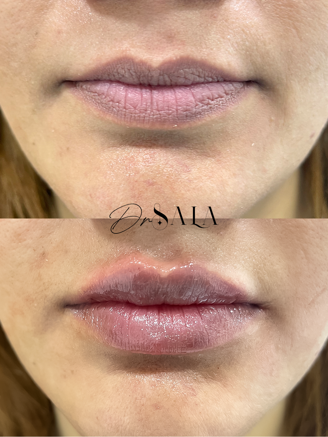 حالة قبل وبعد 1