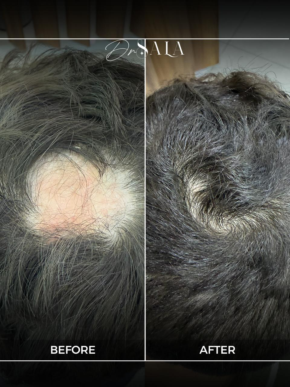 حالة قبل وبعد 3